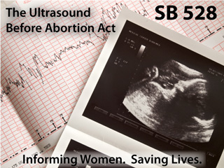 SB 528: Ultrasound Before Abortion Act